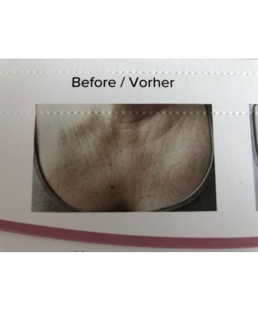 Anti-Wrinkle Silicone D collet Pads | Self-Adhesive for Youthful Skin Appearance - Buy Online on GoSupps.com