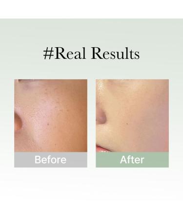 Glow Hyssop Serum - Hydrating Anti-Aging Skin Serum | Achieve Korean Glass Skin with 30% Vitamins A C E & 10% Niacinamide - Shop Internationally - Buy Online on GoSupps.com