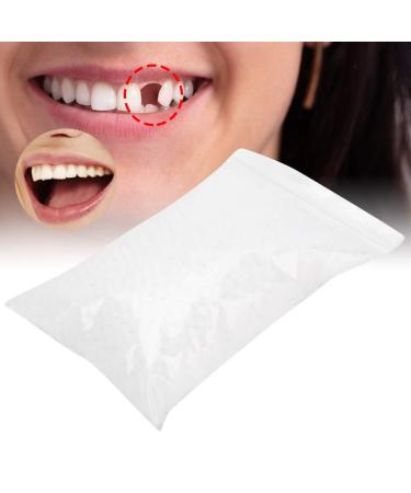 Temporary Tooth Repair Kit - Dental Filling Material (100g) - Buy Online on GoSupps.com