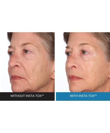 Shop Serious Skincare INSTA-TOX Serum & Reverse Lift Eye Cream Set - Anti-Aging Wrinkle Smoothing & Firming Solution - International Shipping Available - Buy Online on GoSupps.com