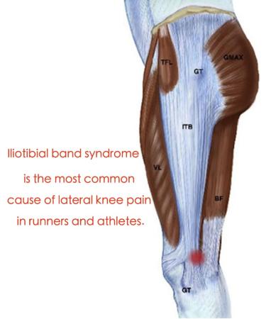 Thigh Compression Strap - Iliotibial Band Brace for Pain Relief in Running Basketball Football & Gym - Ideal for Patellar Tendonitis (Black - Buy Online on GoSupps.com