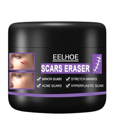 10/30/50g Scar Repair Cream Acne Scar Removal Pigmentation Corrector Remove