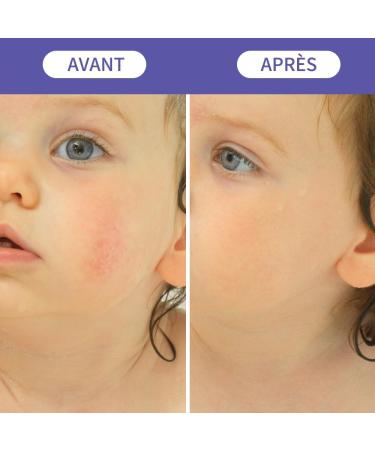 Bee Nature - Baby Face Moisturizer - Organic Honey - Relieve Eczema - Softness Repair - 100% Natural - Suitable for Newborns with Dry and Sensitive Skin - 2 Pieces (2 * 50ml) - Buy Online on GoSupps.com