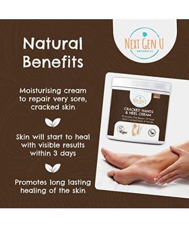 Next Gen U Hand & Heel Cream 250ml - Vegan Intensive Moisturizer for Very Dry Hands & Feet - Softens Hard Calluses, Natural Care for Sore Winter Heels - Men & Women - Buy Online on GoSupps.com
