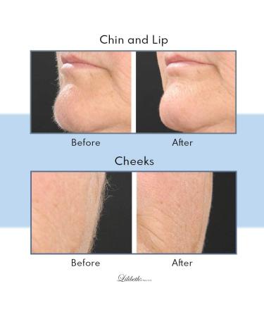 Lilibeth from New York Pink Package Brow Shaper Hygienic Pain-Free Hair Removal & Dermaplaning Tool for All Hair & Skin Types - Buy Online on GoSupps.com