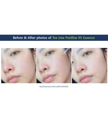 Dr. Ceuracle Tea Tree Purifine 95 Essence 50ml - Purifying & Soothing Serum - Buy Online on GoSupps.com