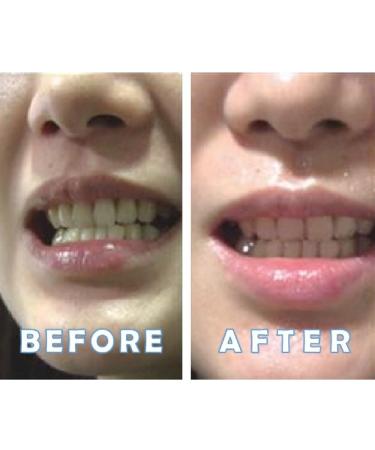 Ultrasonic Electric Toothbrush Adult U Shaped Toothbrush 4 Modes Whole Mouth Toothbrush Whitening Wireless Charging IPX7 Waterproof(White) - Buy Online on GoSupps.com