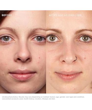 R+F Lash Boost Enhancements Eyebrows Serum | Enhance & Nourish Your Brows | International Shipping - Buy Online on GoSupps.com