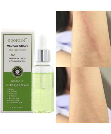 GOOPGEN Scar Repair Serum 30ml - For Acne, Stretch Marks, and Surgical Scars - Buy Online on GoSupps.com