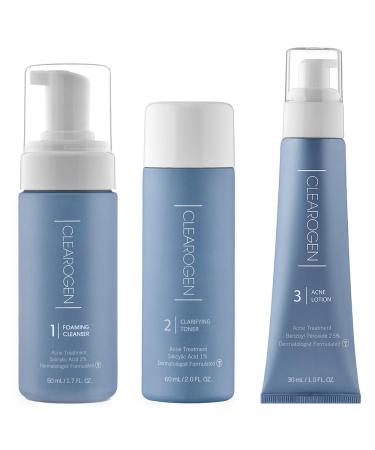 Hormonal Acne Solution Natural Anti-DHT Ingredients Formula Benzoyl Peroxide 1 Month Original Benzoyl Kit