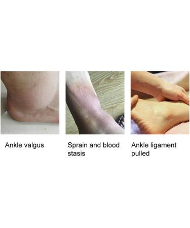 SEBS Magnetic Ankle Bandage | Flexible Elastic & Breathable Ankle Support for Men & Women - Buy Online on GoSupps.com