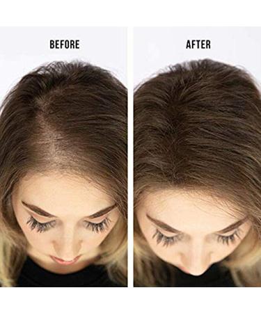 R-Kerhair 100% Natural Keratin Hair Fibers (27g - Black) | Instantly Thicker Hair | Worldwide Shipping - Buy Online on GoSupps.com