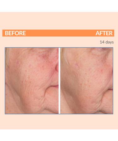 Serious Skincare Serious-C3 Plasma Vitamin C Day Trio | C Cream SPF 30 Vitamin C Serum & C-Eye Treatment for Radiant Skin - Buy Online on GoSupps.com