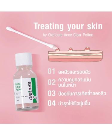Oxe Cure Acne Clear Potion 15 ml - Fast-Acting Acne Treatment | Shop Internationally - Buy Online on GoSupps.com