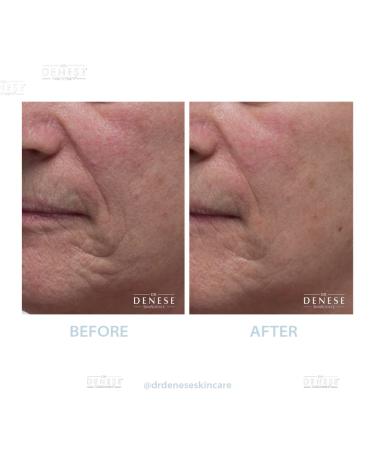 Dr. Denese Collagen Firming Peel Off Mask | Anti-Aging AHA Mask | 4 FL oz for Tightening Skin - Buy Online on GoSupps.com