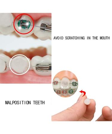 Braces Wax - Orthodontic Wax for Pain Relief | 25 Strips | 5-Pack Dental Wax for Braces - Buy Online on GoSupps.com