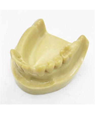 Fhuili Teeth Implant Model - Realistic Dental Simulation for Practice & Education | Lower Half Teeth Demonstration Model - Buy Online on GoSupps.com