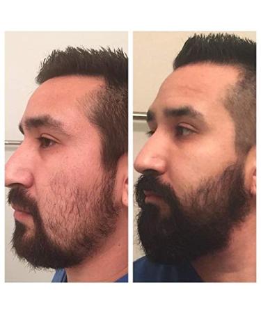 Buy EBeizi Beard Growth Set for Men | Stimulate Hair Growth with Beard Oil & 0.5mm Dermaroller | Shop Now for International Shipping - Buy Online on GoSupps.com