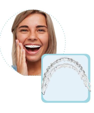 Tecnidentusa Clip-On Comfort Lip ShieldMouth Protector Guard for Braces Dental Wax Alternative - Buy Online on GoSupps.com