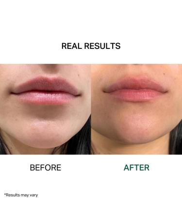 Y'OUR Intensive Lip Balm | Nourishing Shea Butter & Rosehip Oil | Paraben-Free | Lightweight & Moisturizing | 15ml Extreme Dry Lip Care - Buy Online on GoSupps.com