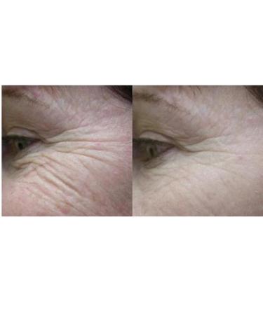 Ultra Moisture Cream - Deep Hydration for All Skin Types | International Shipping Available - Buy Online on GoSupps.com