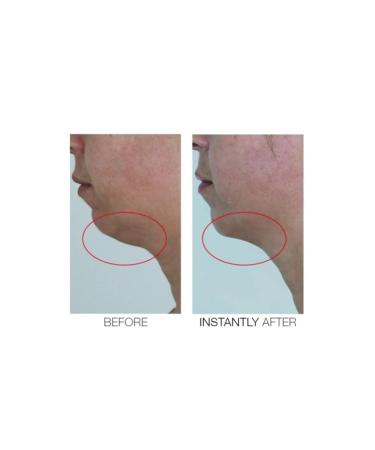 Mirenesse Cosmetics Chin Tuck V Shape Lifting Serum - Lift and Firm Your Jawline - Buy Online on GoSupps.com