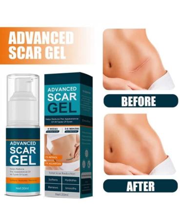 Kelo-cote Scar Gel 15g-2 Pack | Advanced Formula for Surgical, Stretch Marks, C-section, Cosmetic Surgery, Burn & Children's Scars | Softens, Flattens, Eliminates Redness - Buy Online on GoSupps.com
