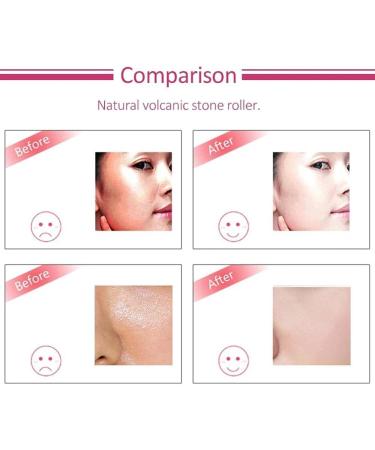 Volcanic Oil-Absorbing Face Roller | Oil Control Stick for Shrink Pores | Reusable Skincare Tool - Mini Massage Perfect for On-the-Go - Buy Online on GoSupps.com