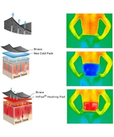 TherMedic PW140 Lower Back Pro Wrap - Hot & Cold Therapy (Heating Pad and Cold Pack) /L attelle TherMedic 3-in-1 pour le lombaire en thermoth rapie et cryoth rapie - Buy Online on GoSupps.com