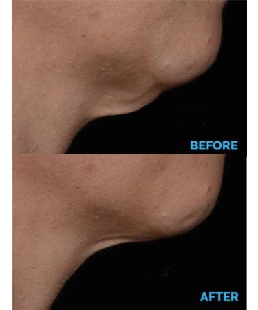 N.E.C.K Control: Neck Lifting Firming & Retracting Cream - Best Anti-Aging Solution for a Youthful Neck | Shop Now Internationally - Buy Online on GoSupps.com