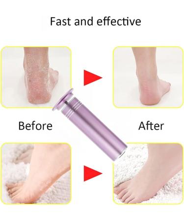 Adjustable Speed Electric Foot Sharpener 1200 RPM Dead Skin Remover with 60 Sandpaper Discs - Buy Online on GoSupps.com