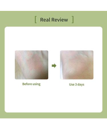 OxygenCeuticals Skin Barrier Ato Cream Protective Cream with Fucoidan V, Shea Butter & Centella Asiatica, Strengthen Skin Barrier & Soothe Sensitive Skin. 4.05 fl.oz (120ml) 4.1 Fl Oz (Pack of 1) - Buy Online on GoSupps.com