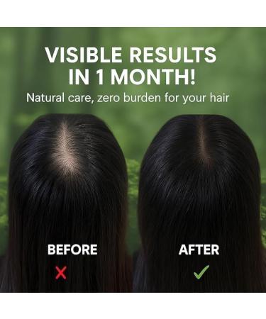 Nature-Triangle 2-Pack Shampoo Bars for Men and Women - Buy Online on GoSupps.com