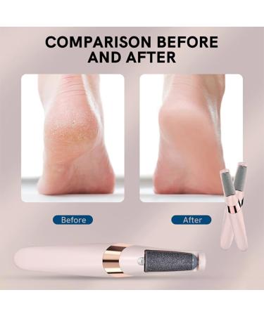 dijiusidy Electric Foot File Rechargeable Adjustable 2 Speed Cordless Callus Electronic Hard Removal Pedicure Supplies - Buy Online on GoSupps.com