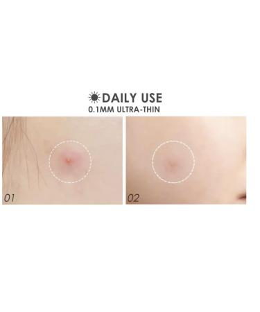 Buy Acne Pimple Patch (24 Patches) - Invisible Hydrocolloid Healing Patches for Zit & Pimple Care | Waterproof & Absorbs Pus | Fast Shipping Worldwide - Buy Online on GoSupps.com