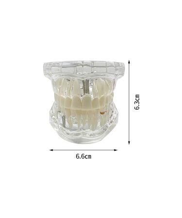 Buy Youya Transparent Dental Tooth Model for Dentists | Removable Pathological Teaching Model | International Shipping Available - Buy Online on GoSupps.com