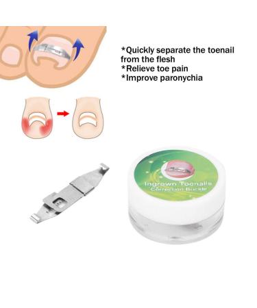 Ingrown Toenail Treatment Kit for Pain Relief - Paronychia Corrector Tool Set for Salon and Home Use - Buy Online on GoSupps.com