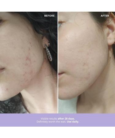 NOVA ENGEL Azelaic Radiance S rum 50 Ml - Buy Online on GoSupps.com