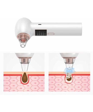 HOHXFYP Blackhead Remover Pore Vacuum Strong Suction Electric Comedone Whitehead Extractor Tools with 5 Probes USB Rechargeable Facial Fat Particle Removal(ABS-White) ABS White - Buy Online on GoSupps.com