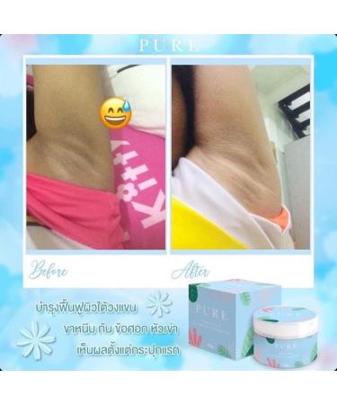 PURE Underarm Cream Toning Essence 50g - Brighten Bikini Line & Reduce Dark Spots - Buy Online on GoSupps.com