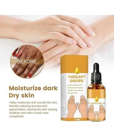 (SUMMER MUST) Best NigriCare Therapy Drops TAIMEI 2024 New Acanthosis Nigricans Therapy Oil Dark Spot Corrector Oil Brightens Joint Complexion for Neck Hands Elbows (2pc) - Buy Online on GoSupps.com