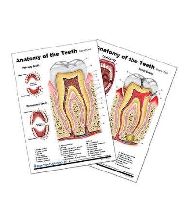 Tooth Anatomy & Implant Repair Support Card Set - Enhance Dental Knowledge | International Shipping Available - Buy Online on GoSupps.com