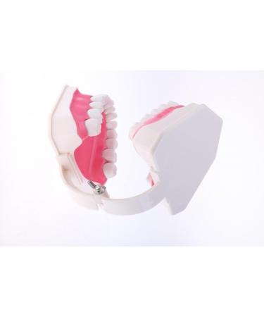 F Fityle 2X Magnification Model Teeth - Removable PVC for Dental Education | International Shipping Available - Buy Online on GoSupps.com
