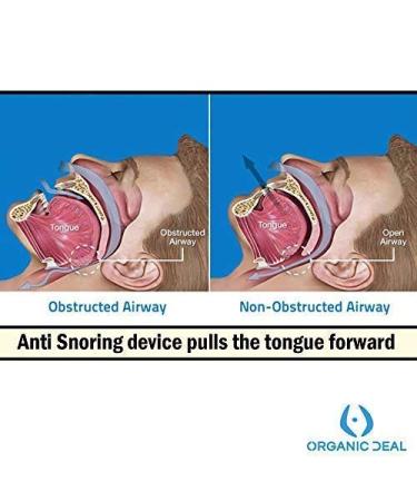 Organic Deal Anti Snore Tongue Retainer - Sleep Aid to Stop Snoring - Effective Snore Stopper Mouth Guard for Women & Men - Buy Online on GoSupps.com