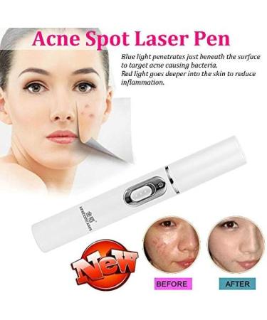 Spot Treatments Pen Red-Ray Ance Remover Therapy|Removal Picosecond Pen|Acne Spot Laser Pen Soft Scar Wrinkle Removal Device Activate Skin/Tighten Loosen Skin - Buy Online on GoSupps.com