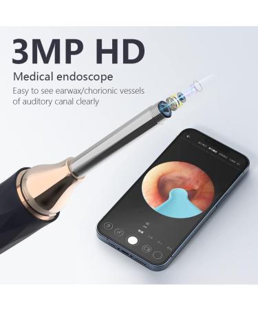 1080P Ear Camera Ear Wax Removal Tool Kit with 8 Ear Tips & LED Lights - Blue - Buy Online on GoSupps.com