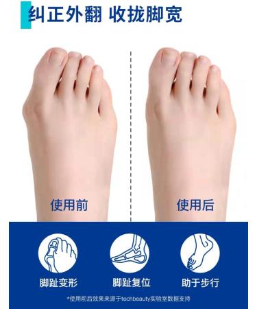 Orthopedic Toe Corrector for Men and Women - Thumb Valgus Relief - Buy Online on GoSupps.com