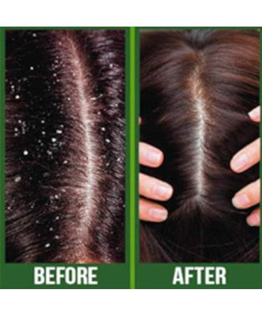 Difeel Premium Castor Plus Tea Tree Hair Oil - Pro-Growth & Scalp Care 2.5 oz - Buy Online on GoSupps.com