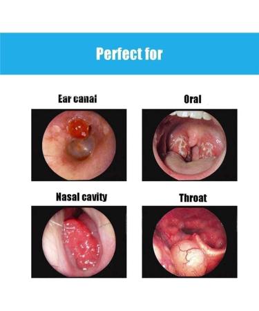 SMSOM Earwax Removal Camera - HD Waterproof Tool for Adults & Children | Effective Ear Cleaning & Visualization - Buy Online on GoSupps.com