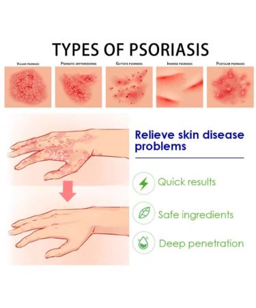 20g Soothing Skin Care Ointment for Itchy Body Treatment - Buy Online on GoSupps.com